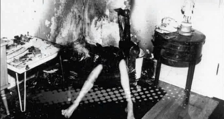 Woman Legs Chair Burned